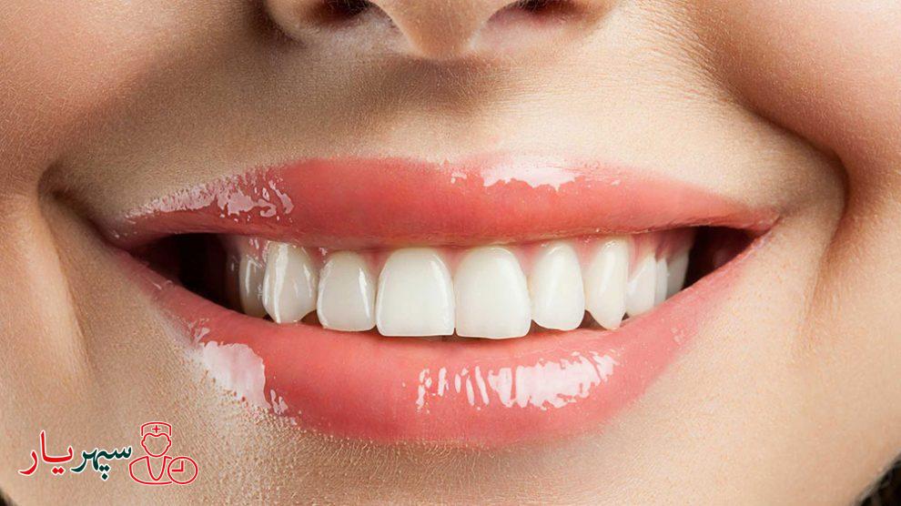 معرفی مواد غذایی که باعث ایجاد لک برروی دندان ها میشوند.