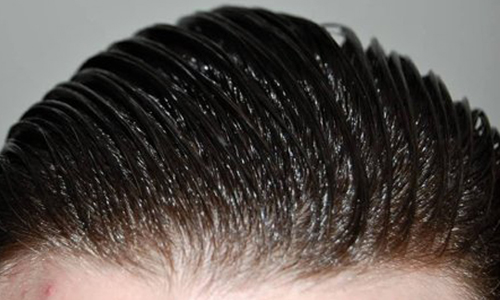 درمان موی چرب با روشهای آسان