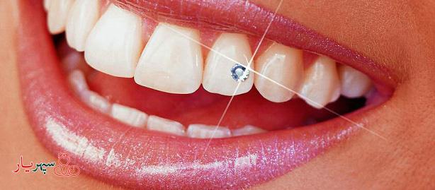 روش های طبیعی سفید کردن دندان